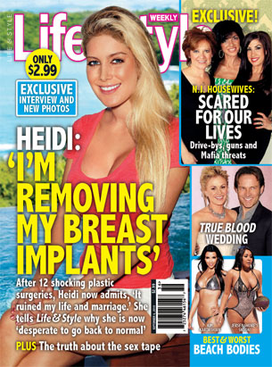 heidi montag surgery gone wrong. gone wrong, Heidi Montag,