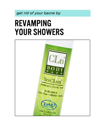 To Clear Back Acne, Shower Smarter 