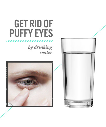 Cure Puffy Eyes With H2O