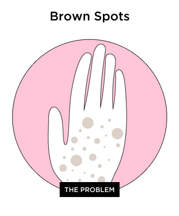 The Giveaway: Brown Spots