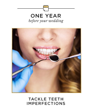 One Year Before Your Wedding: Tackle Teeth Imperfections 