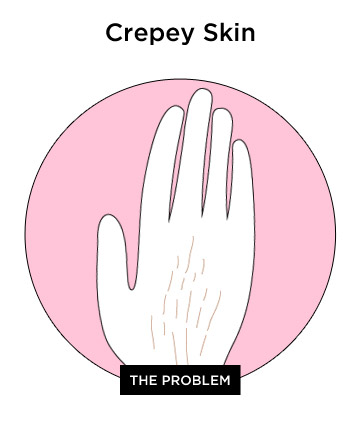 The Giveaway: Crepey Skin
