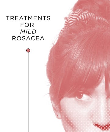 Treatments for Mild Rosacea