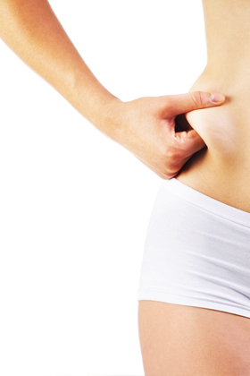 Mistake No. 3: New fat appears in new (and unwanted) places after liposuction