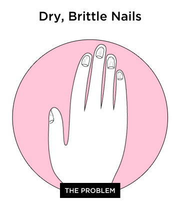 The Giveaway: Dry, Brittle Nails