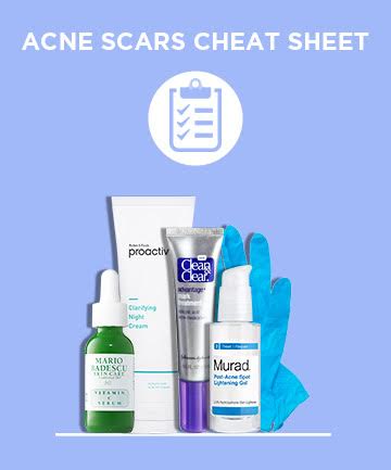 Your Get Rid of Acne Scars To-Do List