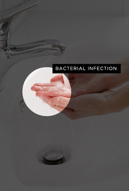 Bacterial infection 
