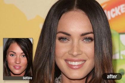Worst Plastic Surgery Face on The Best  Megan Fox  Best And Worst Celebrity Plastic Surgery