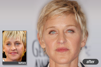 Celebrity Picture on The Best  Ellen Degeneres  Best And Worst Celebrity Plastic Surgery