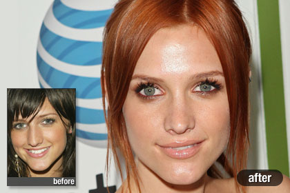  Celebrity Plastic Surgery on Best  Ashlee Simpson Wentz  Best And Worst Celebrity Plastic Surgery