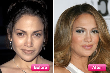 Jennifer Lopez Eyebrows on Jennifer Lopez  Celebrity Eyebrow Makeovers