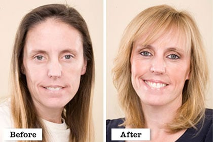 The Extreme and Extremely Beautiful Makeover