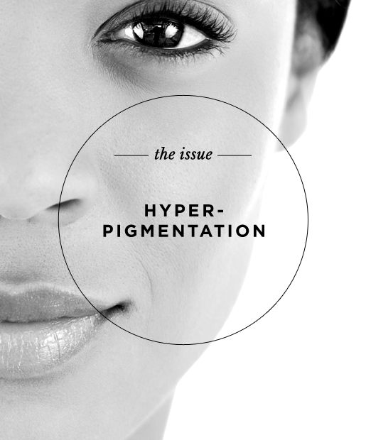 The Issue: Hyperpigmentation