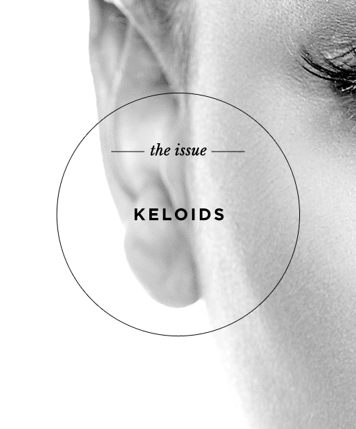 The Issue: Keloids 