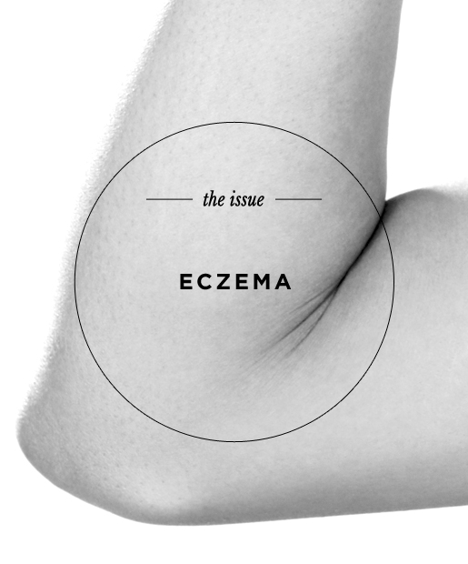 The Issue: Eczema