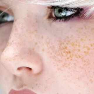Would You Get a 'No Knife' Nose Job?