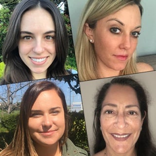 Everything You Need to Know About Chemical Peels