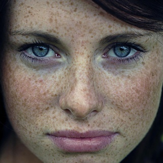 Teledermatology: Diagnosing Skin Conditions Using Photos
