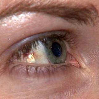 No, Just No: Eye Bling Is Now A Thing