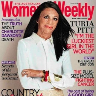 Inspirational Burn Victim Covers Women's Magazine