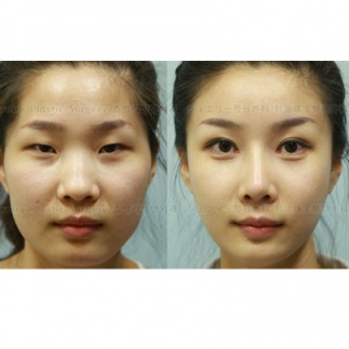 Korea's Plastic Surgery Industry Has Created A Passport Problem