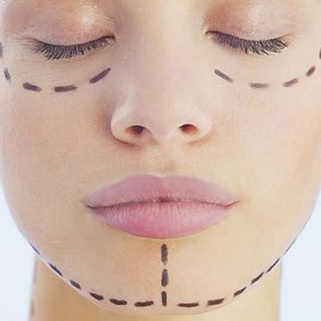 Korean Teens Are Getting DIY Plastic Surgery