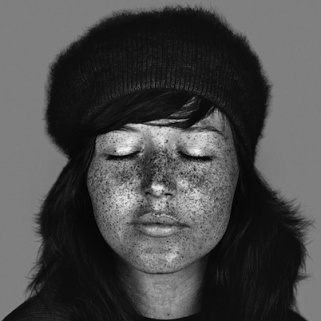 Sobering New UV Photos Reveal Dramatic, Pervasive Sun Damage