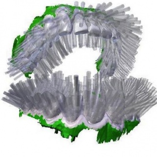 Get Your Teeth Fully Clean In 6 Seconds. It's Possible. Really.