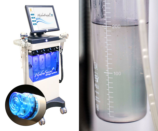 On the left, the Hydrafacial machine. On the right, an example of the kind of gunk it's sucking out of your pores. 