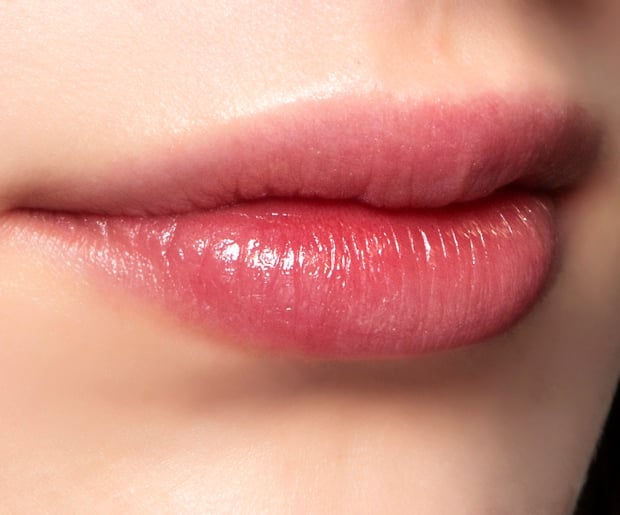 Tips for Getting Rid of Dry Patch on Lip