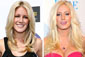 Has Celebrity Plastic Surgery Gone Too Far?