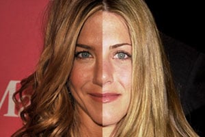 Celebrity Endorsement on Best And Worst Celebrity Plastic Surgery