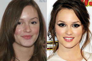 Ugly Duckling Celebs