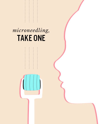 Microneedling, Take One