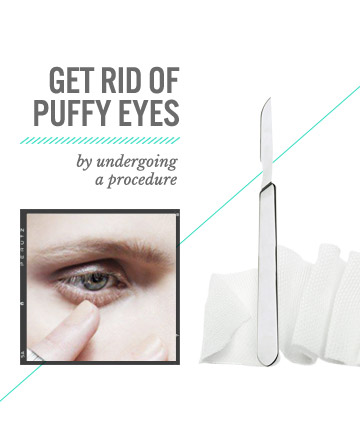 How to Get Rid of Puffy Eyes