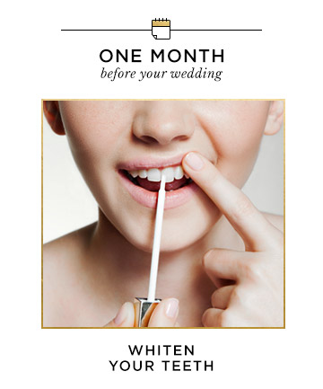 One Month Before Your Wedding: Whiten Teeth 