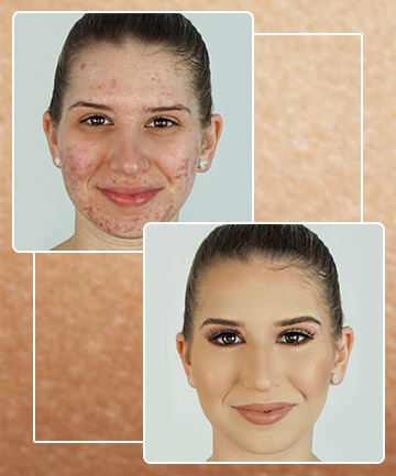 For All-Over Coverage