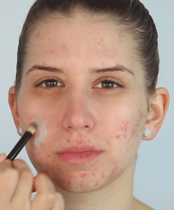 The Secret to Minimizing Redness