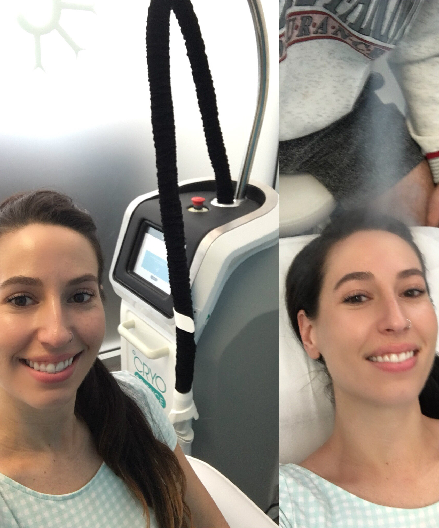 Trying Targeted Cryotherapy