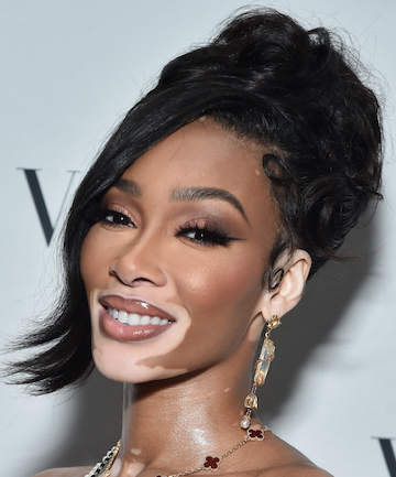 Winnie Harlow