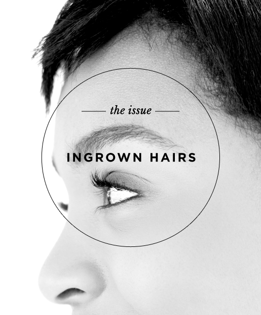 The Issue: Ingrown Hairs