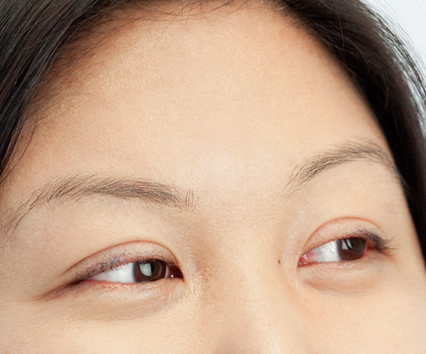 do asians have eyelids