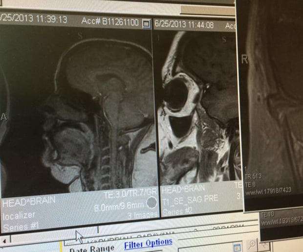 How many people can say their double chin is visible on an MRI? Hilarious. 